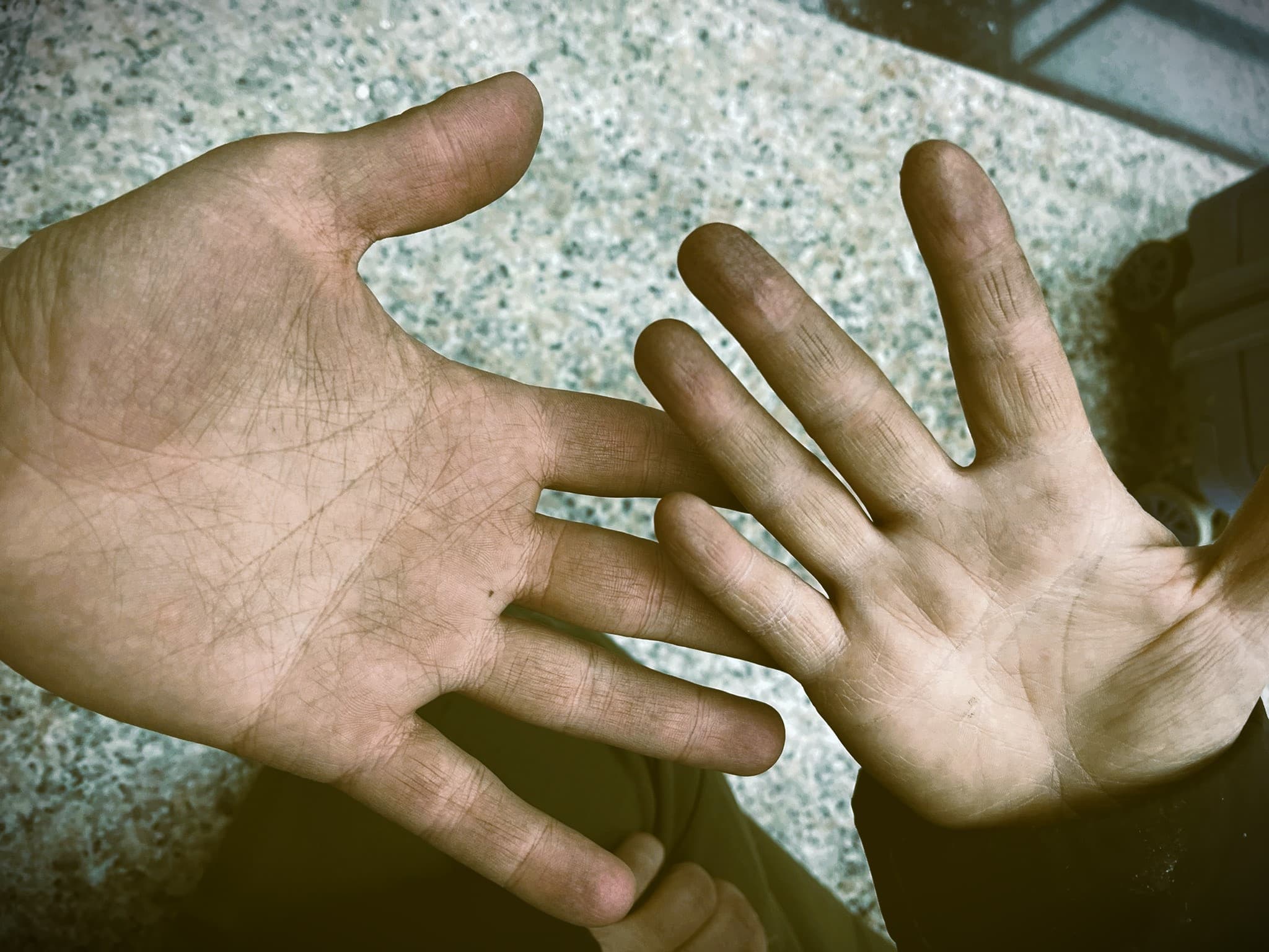 Onkoloji Hastalarına Umut